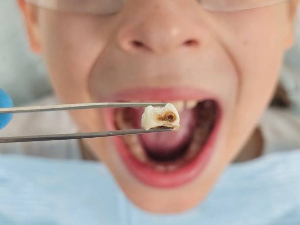 Best Pediatric Emergency Dentist in West Hazleton, PA